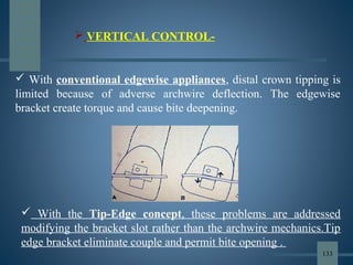  With conventional edgewise appliances, distal crown tipping is
limited because of adverse archwire deflection. The edgewise
bracket create torque and cause bite deepening.
 With the Tip-Edge concept, these problems are addressed
modifying the bracket slot rather than the archwire mechanics.Tip
edge bracket eliminate couple and permit bite opening .
 VERTICAL CONTROL-
133
 