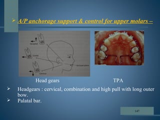  A/P anchorage support & control for upper molars –
Head gears TPA
 Headgears : cervical, combination and high pull with long outer
bow.
 Palatal bar.
147
 