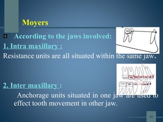 According to the jaws involved:
1. Intra maxillary :
Resistance units are all situated within the same jaw.
2. Inter maxillary :
Anchorage units situated in one jaw are used to
effect tooth movement in other jaw.
15
Moyers
 