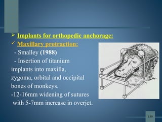  Implants for orthopedic anchorage:
 Maxillary protraction:
- Smalley (1988)
- Insertion of titanium
implants into maxilla,
zygoma, orbital and occipital
bones of monkeys.
-12-16mm widening of sutures
with 5-7mm increase in overjet.
159
 