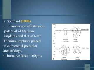  Southard (1995)
• Comparison of intrusion
potential of titanium
implants and that of teeth
Titanium implants placed
in extracted 4 premolar
area of dogs.
• Intrusive force = 60gms
162
 