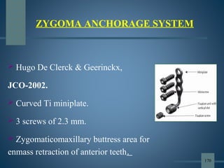 ZYGOMA ANCHORAGE SYSTEM
 Hugo De Clerck & Geerinckx,
JCO-2002.
 Curved Ti miniplate.
 3 screws of 2.3 mm.
 Zygomaticomaxillary buttress area for
enmass retraction of anterior teeth.
170
 