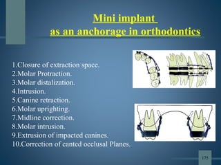 1.Closure of extraction space.
2.Molar Protraction.
3.Molar distalization.
4.Intrusion.
5.Canine retraction.
6.Molar uprighting.
7.Midline correction.
8.Molar intrusion.
9.Extrusion of impacted canines.
10.Correction of canted occlusal Planes.
Mini implant
as an anchorage in orthodontics
175
 