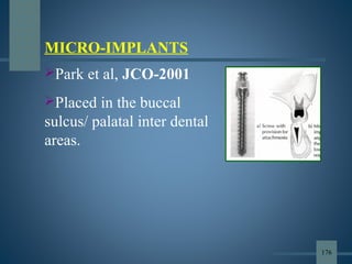 MICRO-IMPLANTS
Park et al, JCO-2001
Placed in the buccal
sulcus/ palatal inter dental
areas.
176
 