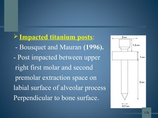  Impacted titanium posts:
- Bousquet and Mauran (1996).
- Post impacted between upper
right first molar and second
premolar extraction space on
labial surface of alveolar process
Perpendicular to bone surface.
178
 