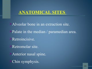 Alveolar bone in an extraction site.
Palate in the median / paramedian area.
Retroincisive.
Retromolar site.
Anterior nasal spine.
Chin symphysis.
ANATOMICAL SITES
181
 