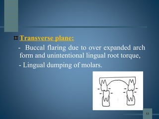 Transverse plane:
- Buccal flaring due to over expanded arch
form and unintentional lingual root torque,
- Lingual dumping of molars.
53
 