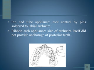 • Pin and tube appliance: root control by pins
soldered to labial archwire.
• Ribbon arch appliance: size of archwire itself did
not provide anchorage of posterior teeth.
66
 