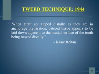 “ When teeth are tipped distally as they are in
anchorage preparation, osteoid tissue appears to be
laid down adjacent to the mesial surface of the tooth
being moved distally.”
- Kaare Reitan
TWEED TECHNIQUE: 1944
67
 