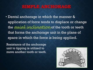 SIMPLE ANCHORAGE
• Dental anchorage in which the manner &
application of force tends to displace or change
the axial inclination of the tooth or teeth
that forms the anchorage unit in the plane of
space in which the force is being applied.
Resistance of the anchorage
unit to tipping is utilized to
move another tooth or teeth.
 