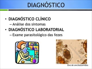 DIAGNÓSTICO
• DIAGNÓSTICO CLÍNICO
– Análise dos sintomas

• DIAGNÓSTICO LABORATORIAL
– Exame parasitológico das fezes

Ovo de ancilostomídeo

 