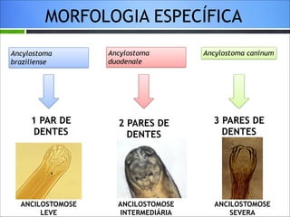 MORFOLOGIA ESPECÍFICA
Ancylostoma
braziliense

1 PAR DE
DENTES

ANCILOSTOMOSE
LEVE

Ancylostoma
duodenale

Ancylostoma caninum

2 PARES DE
DENTES

3 PARES DE
DENTES

ANCILOSTOMOSE
INTERMEDIÁRIA

ANCILOSTOMOSE
SEVERA

 