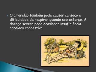  O amarelão também pode causar cansaço e
dificuldade de respirar quando sob esforço. A
doença severa pode ocasionar insuficiência
cardíaca congestiva.
 