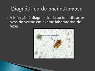  A infecção é diagnosticada ao identificar os
ovos do verme em exame laboratorias de
fezes.
 