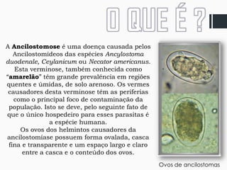 DOENÇA - Ancilostomose (amarelão) - BIOLOGIA | PPTX
