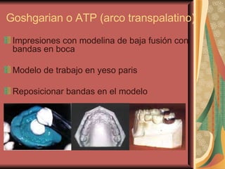 Goshgarian o ATP (arco transpalatino) <ul><li>Impresiones con modelina de baja fusión con bandas en boca </li></ul><ul><li...