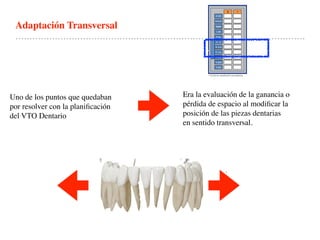 Adaptación Transversal
Uno de los puntos que quedaban
por resolver con la planiﬁcación
del VTO Dentario
Era la evaluación de la ganancia o
pérdida de espacio al modiﬁcar la
posición de las piezas dentarias
en sentido transversal.
.
 