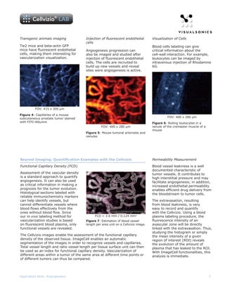 Transgenic animals imaging              Injection of fluorescent endothelial         Visualization of Cells
                                        cells
Tie2 mice and beta-actin GFP                                                         Blood cells labeling can give
mice have fluorescent endothelial       Angiogenesis progression can                 critical information about the
cells, making them interesting for      also be imaged and studied after             cell-wall interaction. For example,
vascularization visualization.          injection of fluorescent endothelial         leukocytes can be imaged by
                                        cells. The cells are recruited to            intravenous injection of Rhodamine
                                        build up new vessels and reveal              6G.
                                        sites were angiogenesis is active.




         FOV: 415 x 300 µm

Figure 4: Capillaries of a mouse
subcutaneous prostate tumor stained                                                           FOV: 400 x 280 µm
with FITC-Albumin                                                                    Figure 6: Rolling leukocytes in a
                                                  FOV: 400 x 280 µm                  venule of the cremaster muscle of a
                                                                                     mouse
                                        Figure 5: Mouse tumoral arterioles and
                                        venules




Beyond Imaging: Quantification Examples with the Cellvizio                           Permeability Measurement

Functional Capillary Density (FCD)                                                   Blood vessel leakiness is a well
                                                                                     documented characteristic of
Assessment of the vascular density                                                   tumor vessels. It contributes to
is a standard approach to quantify                                                   high interstitial pressure and may
angiogenesis. It can also be used                                                    facilitate angiogenesis; in addition,
as critical information in making a                                                  increased endothelial permeability
prognosis for the tumor evolution.                                                   enables efficient drug delivery from
Histological sections labeled with                                                   the bloodstream to tumor cells.
reliable immunochemistry markers
can help identify vessels, but                                                       The extravasation, resulting
cannot differentiate vessels where                                                   from blood leakiness, is very
blood flows effectively from the                                                     easy to record and quantify
ones without blood flow. Since                                                       with the Cellvizio. Using a blood
our in vivo labeling method for               FCD = 3.6 mm / 0.124 mm2               plasma labeling procedure, the
vascularization studies is based        Figure 7: Estimation of blood vessel         fluorescence intensity of an
on fluorescent blood plasma, only       length per area unit on a Cellvizio image.   avascular zone will be directly
functional vessels are revealed.                                                     linked with the extravasation. Thus,
                                                                                     studying the histogram or simply
The Cellvizio images enable the assessment of the functional capillary               the mean intensity of a given
density of the observed tissue. ImageCell enables an automatic                       region of interest (ROI) reveals
segmentation of the images in order to recognize vessels and capillaries.            the evolution of the amount of
Total vessel length and ratio vessel length per tissue surface unit can then         plasma that has leaked to the ROI.
be used as an index for functional capillary density. Vascularization of             With ImageCell functionalities, this
different areas within a tumor of the same area at different time points or          analysis is immediate.
of different tumors can thus be compared.




Application Note: Angiogenesis                                                                                             3
 