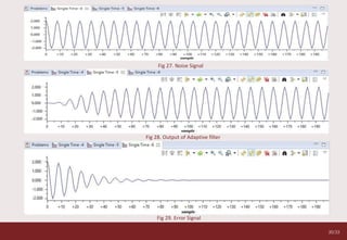 30/33
Hardware Implementation
Fig 27. Noise Signal
Fig 28. Output of Adaptive filter
Fig 29. Error Signal
 