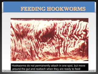 Hookworms do not permanently attach in one spot, but move
around the gut and reattach when they are ready to feed.
10/12/16asifkanth89@gmail.com
 