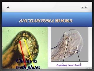 ChitinousChitinous
teeth platesteeth plates 10/12/16asifkanth89@gmail.com
 
