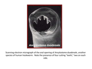 Scanning electron micrograph of the oral opening of Ancylostoma duodenale, another
species of human hookworm. Note the presence of four cutting "teeth," two on each
side.
 