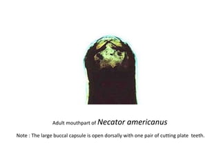 Adult mouthpart of Necator americanus
Note : The large buccal capsule is open dorsally with one pair of cutting plate teeth.
 