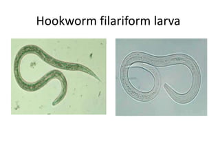 Hookworm filariform larva
HG
 