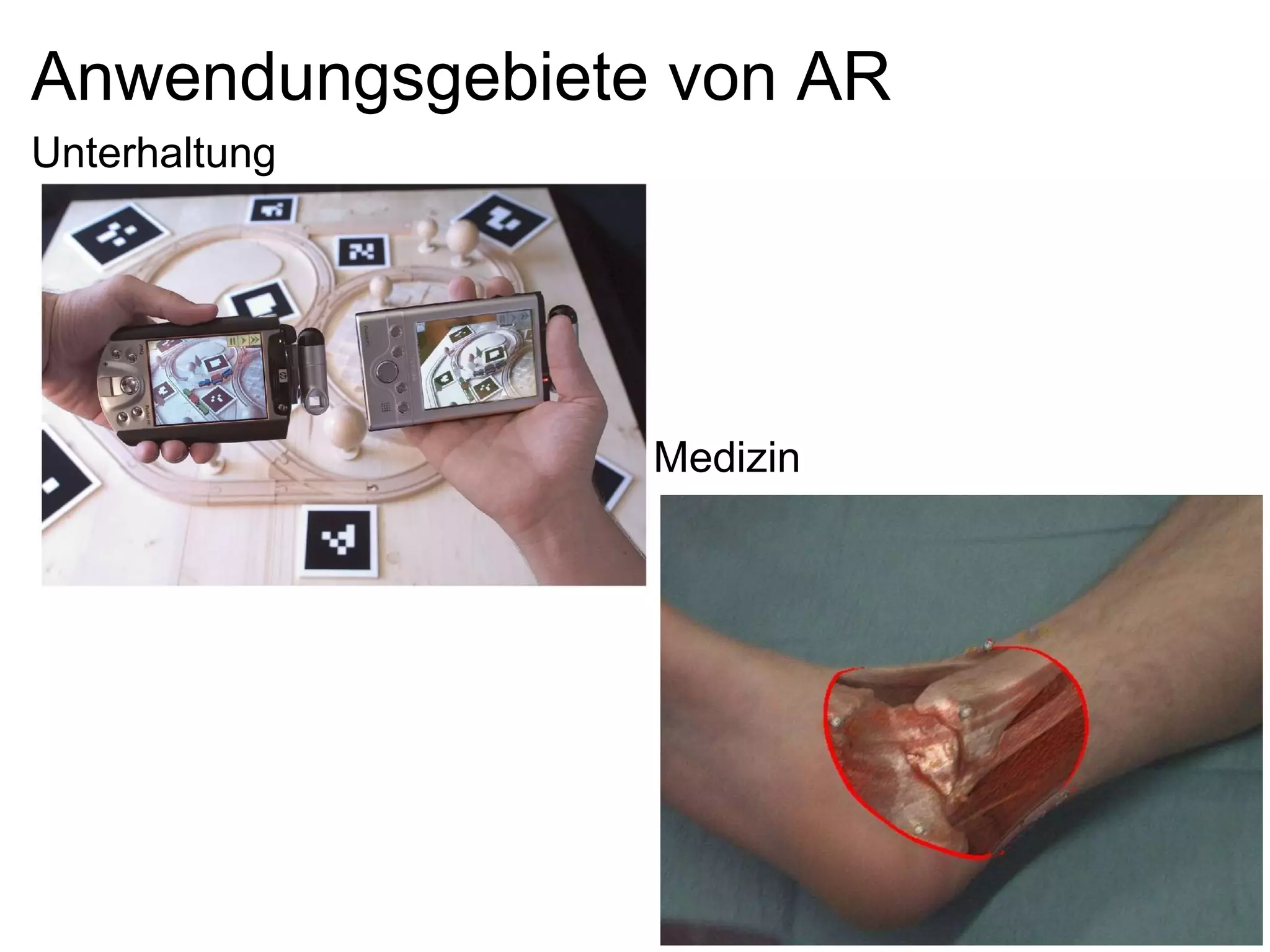 Anwendungsgebiete von AR Unterhaltung Medizin 