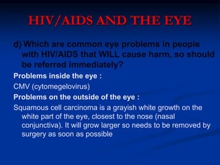 HIV/AIDS AND THE EYE DISORDERS IN ALL AGE GROUP | PPT