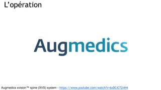 L’opération
Augmedics xvision™ spine (XVS) system - https://www.youtube.com/watch?v=6xDCiCT2nH4
 