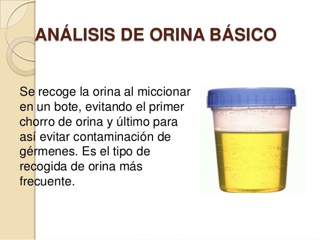ANALISIS DE ORINA ANALISIS DE ORINA