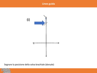 Linee guida
Segnare la posizione della valva brachiale (dorsale)
 