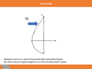 Linee guida
Disegnare solo su un lato la linea guida della valva peduncolare
Per linee naturali meglio disegnare con il braccio bloccando il polso
 