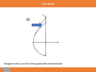Linee guida
Disegnare solo su un lato la linea guida della valva brachiale
 