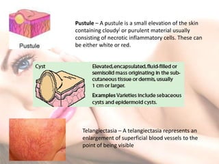 skin lesions | PPTX