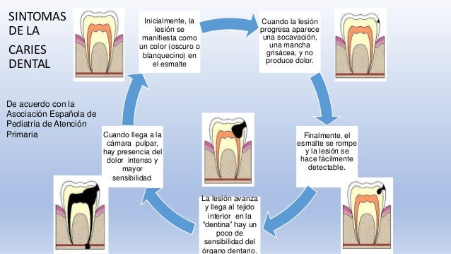 Etiología de la caries dental
