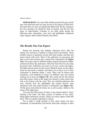 Andreas Moritz
104
10:00-10:30AM: You may drink freshly pressed fruit juice at this
time. One half-hour later you may eat one or two pieces of fresh fruit.
One hour later you may eat regular (but light) food. By the evening or
the next morning you should be back to normal, and feel the first
signs of improvement. Continue to eat light meals during the
following days. Remember, your liver and gallbladder underwent
major surgery, albeit without harmful side effects.
The Results You Can Expect
During the morning and, perhaps, afternoon hours after the
cleanse you will have a number of watery bowel movements. These
initially consist of gallstones mixed with food residue, and then just
stones mixed with water. Most of the gallstones are pea-green and
float in the toilet because they contain bile compounds (see Figure
13a). The stones come in different shades of green and may be bright-
colored and shiny like gemstones. Only bile from the liver can cause
the green color. Gallstones can come in all sizes, colors and shapes.
The light colored stones are the newest. Blackish stones are the oldest.
Some are pea-sized or smaller, and others are as big as two or three
centimeters in diameter (about 1 inch). There may be dozens and,
sometimes, even hundreds of stones (of different sizes and colors)
coming out at once (see Figure 13b. Also watch out for tan-colored
and white stones. Some of the larger tan-colored or white stones may
sink to the bottom with the stool. They are calcified gallstones that
were released from the gallbladder and contain heavier toxic
substances with only small amounts of cholesterol (see Figure 13c).
All the green and yellowish stones are as soft as putty, thanks to the
action of the apple juice.
You may also find a layer of white or tan-colored chaff or ‘foam’
floating in the toilet. The foam consists of millions of tiny white,
sharp-edged cholesterol crystals, which can easily rupture small bile
ducts. They are equally important to release.
Try to make a rough estimate of how many stones you have
eliminated. To permanently cure bursitis, back pain, allergies or other
 