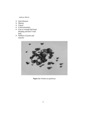 Andreas Moritz
4
Joint diseases
Obesity
Cancer
Cold extremities
Cuts or wounds that keep
bleeding and don’t want
heal
Stiffness of joints and
muscles
Figure 1a: Flushed out gallstones
 