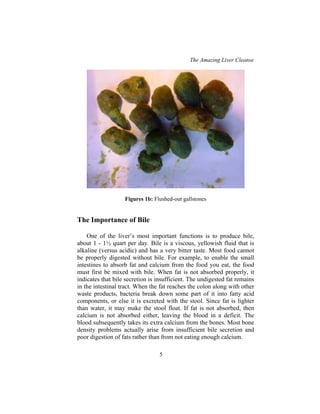 The Amazing Liver Cleanse
5
Figures 1b: Flushed-out gallstones
The Importance of Bile
One of the liver’s most important functions is to produce bile,
about 1 - 1½ quart per day. Bile is a viscous, yellowish fluid that is
alkaline (versus acidic) and has a very bitter taste. Most food cannot
be properly digested without bile. For example, to enable the small
intestines to absorb fat and calcium from the food you eat, the food
must first be mixed with bile. When fat is not absorbed properly, it
indicates that bile secretion is insufficient. The undigested fat remains
in the intestinal tract. When the fat reaches the colon along with other
waste products, bacteria break down some part of it into fatty acid
components, or else it is excreted with the stool. Since fat is lighter
than water, it may make the stool float. If fat is not absorbed, then
calcium is not absorbed either, leaving the blood in a deficit. The
blood subsequently takes its extra calcium from the bones. Most bone
density problems actually arise from insufficient bile secretion and
poor digestion of fats rather than from not eating enough calcium.
 