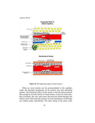 Andreas Moritz
28
Figure 8: The beginning stages of heart disease
When no more protein can be accommodated in the capillary
walls, the basement membranes of the arteries also start absorbing
protein. The beneficial effect of this action is that the blood remains
thin enough to avert the threat of a heart attack, at least for some time.
But eventually, the very same tactic that prevents death damages the
blood vessel walls (only the primary survival mechanisms of the body
are without major side-effects). The inner lining of the artery walls
 