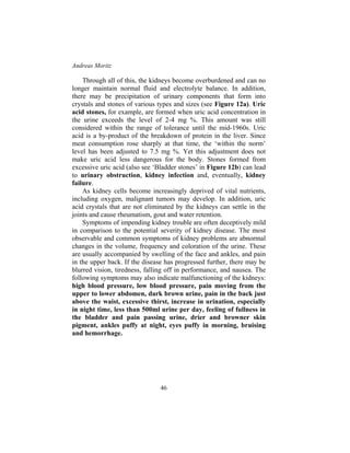 Andreas Moritz
46
Through all of this, the kidneys become overburdened and can no
longer maintain normal fluid and electrolyte balance. In addition,
there may be precipitation of urinary components that form into
crystals and stones of various types and sizes (see Figure 12a). Uric
acid stones, for example, are formed when uric acid concentration in
the urine exceeds the level of 2-4 mg %. This amount was still
considered within the range of tolerance until the mid-1960s. Uric
acid is a by-product of the breakdown of protein in the liver. Since
meat consumption rose sharply at that time, the ‘within the norm’
level has been adjusted to 7.5 mg %. Yet this adjustment does not
make uric acid less dangerous for the body. Stones formed from
excessive uric acid (also see ‘Bladder stones’ in Figure 12b) can lead
to urinary obstruction, kidney infection and, eventually, kidney
failure.
As kidney cells become increasingly deprived of vital nutrients,
including oxygen, malignant tumors may develop. In addition, uric
acid crystals that are not eliminated by the kidneys can settle in the
joints and cause rheumatism, gout and water retention.
Symptoms of impending kidney trouble are often deceptively mild
in comparison to the potential severity of kidney disease. The most
observable and common symptoms of kidney problems are abnormal
changes in the volume, frequency and coloration of the urine. These
are usually accompanied by swelling of the face and ankles, and pain
in the upper back. If the disease has progressed further, there may be
blurred vision, tiredness, falling off in performance, and nausea. The
following symptoms may also indicate malfunctioning of the kidneys:
high blood pressure, low blood pressure, pain moving from the
upper to lower abdomen, dark brown urine, pain in the back just
above the waist, excessive thirst, increase in urination, especially
in night time, less than 500ml urine per day, feeling of fullness in
the bladder and pain passing urine, drier and browner skin
pigment, ankles puffy at night, eyes puffy in morning, bruising
and hemorrhage.
 