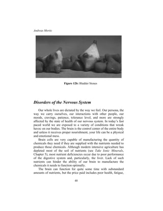 Andreas Moritz
48
Figure 12b: Bladder Stones
Disorders of the Nervous System
Our whole lives are dictated by the way we feel. Our persona, the
way we carry ourselves, our interactions with other people, our
moods, cravings, patience, tolerance level, and more are strongly
affected by the state of health of our nervous system. In today’s fast
paced world we are exposed to a variety of conditions that wreak
havoc on our bodies. The brain is the control center of the entire body
and unless it receives proper nourishment, your life can be a physical
and emotional mess.
Brain cells are very capable of manufacturing the quantity of
chemicals they need if they are supplied with the nutrients needed to
produce those chemicals. Although modern intensive agriculture has
depleted most of the soil of nutrients (see Take Ionic Minerals,
Chapter 5), most nutrient deficiencies occur due to poor performance
of the digestive system and, particularly, the liver. Lack of such
nutrients can hinder the ability of our brain to manufacture the
chemicals it needs to function optimally.
The brain can function for quite some time with substandard
amounts of nutrients, but the price paid includes poor health, fatigue,
 