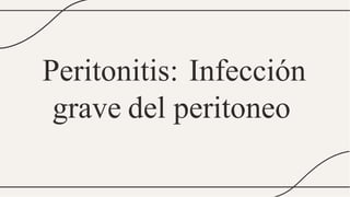 Peritonitis: Infección
grave del peritoneo
 