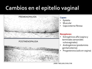  C 
PREMENOPAUSIA 
POSTMENOPAUSIA 
Capas: 
• Epitelio 
• Muscular 
• Capa externa fibrosa 
Receptores: 
• Estrogénicos alfa (vagina y 
terminales sensoriales 
vulvovaginales) 
• Androgénicos (predominio 
genital externo) 
• Progesterona (solo en vagina) 
JAMA 1983;249:2195-2198 
 