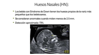 HuesosNasales(HN):
• Losbebés conSíndrome de Down tienen los huesos propios de la nariz más
pequeños que los bebéssanos.
• Seconsideran anormales cuandomiden menos de 2.5mm.
• Detección aproximada:73%
 