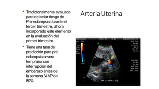 ArteriaUterina
• Tradicionalmente evaluada
para detectar riesgo de
Pre-eclampsia durante el
tercer trimestre, ahora
incorporado este elemento
en la evaluación del
primer trimestre.
• Tiene una tasade
predicción para pre
eclampsia severa
temprana con
interrupción del
embarazo antes de
la semana34VPdel
80%
 