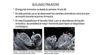 SEGUNDOTRIMESTRE
• Elsegundo trimestre vadesde la semana14ala 26.
• Eneste periodo ya no seobservaránlos cambios dramáticos como los que
semostró durante el primer trimestre.
• Enesta Ecografía por el tamaño fetal y por la abundancia de líquido
amniótico, seconsidera el mejor momento para hacer un diagnóstico
morfológico.
 