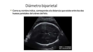 Diámetrobiparietal
• Comosunombre indica, corresponde ala distancia que existe entre los dos
huesos parietales del cráneodel feto.
 