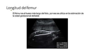 Longitud delfemur
•
Elfémur esel huesomáslargo del feto, por esoseutiliza en la estimación de
la edad gestacional delbebé
 